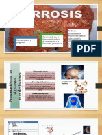 CIRROSIS 