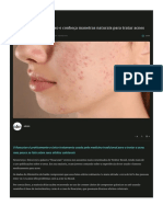 Jogue o Roacutan No Lixo e Conheça Maneiras Naturais para Tratar Acnes