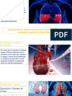 Causas Semi EDEMA P