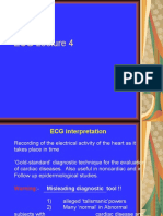 ECG Lecture 4