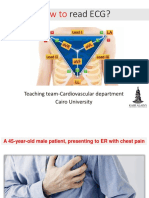 How To: Read ECG?