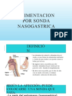 Alimentacion Por Sonda Nasogastrica