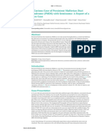 A Curious Case of Persistent Mullerian Duct Syndrome (PMDS) With Seminoma: A Report of A Rare Case