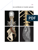 2 - Colonne Vert Brale Et Moelle S - 2011 - Anatomie Du Corps Humain - Atlas D I