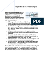 Artificial Reproductive Technologies: Zygote Intrafallopian Transfer (ZIFT) Is A