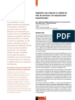 Implantes Que Mejoran La Calidad de Vida de Personas Con Amputaciones Transfemorales