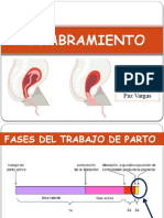 Alumbramiento: Univ. Jose Christopher Paz Vargas