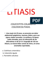 Litiasis QX - MFG