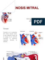 Valvulopatía Mitral