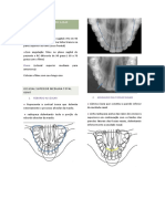 Anatomia Radiográfica Das Oclusais Superiores