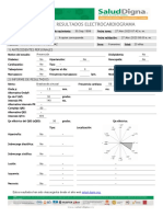 Informe de Resultados Electrocardiograma: 1) Antecedentes Personales