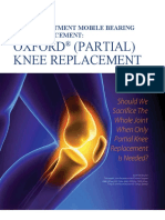 Partial Knee Replacement by DR Goh Eng Tat