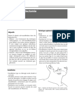 Submandibulectomie