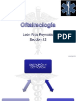 Entropion, Ectropion, Distiquiasis