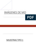 (TOP) Imágenes MO y MET