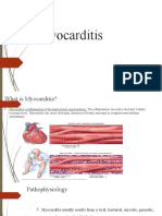 Myocarditis