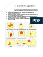 Clasificación de Las Cavidades Según Black