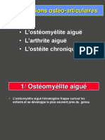 Osteomyelite Aigue