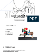 EPIFISIOLÍSIS