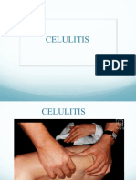 PEFE Celulitis IMMAE