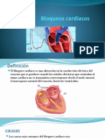 Bloqueos Cardiacos