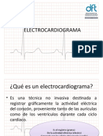 Electrocardiogram A