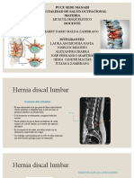 Hernia Discal Lumbar