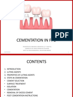 Cementation in FPD