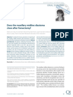 Does The Maxillary Midline Diastema Close After Frenectomy?: Oral Surgery