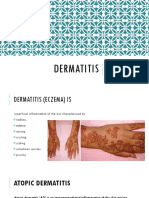 Dermatitis