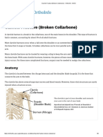 Clavicle Fracture (Broken Collarbone) - OrthoInfo - AAOS