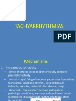 Curs Arrhythmias