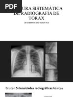 Lectura Sistemática de Radiografía de Tórax Im 2023