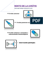 Tratamiento de La Uveítis