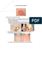 Lesiones Patológicas Primarias