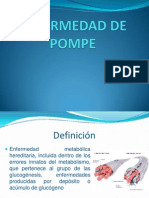 Enfermedad de Pompe