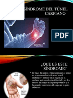 Sindrome - Tunel - Carpiano N