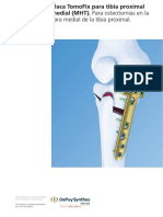 046.000.386 Placa TomoFix para Tibia Proximal Medial