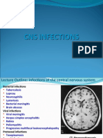 CNS Infections - Meningitis