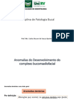 Anomalias Do Desenvolvimento Do Complexo Bucomaxilofacial - Editada