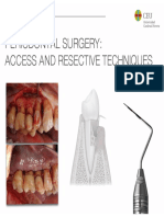 Periodontal Surgery