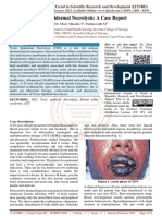 Toxic Epidermal Necrolysis A Case Report