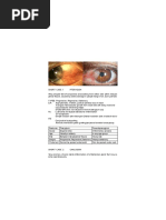 Ophthalmo Short Cases