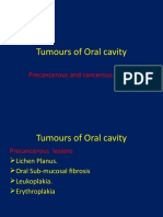 Tumors of Mouth