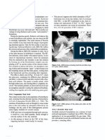 Matrix Acidizing of Sandstone4