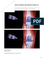 Ya Hay Un Tratamiento Novedoso Que Elimina El Dolor en Las Rodillas