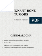 Osteosarcoma