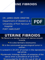 Uterine Fibroids