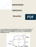 Craneoestenosis Hidrocefalia