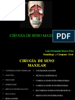 Cirugia de Seno Maxilar